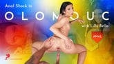 Anal Shock In Olomouc