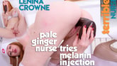 Pale Ginger Nurse Tries Melanin Injection