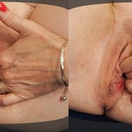 Stepmom Prolapse Her Cervix porn