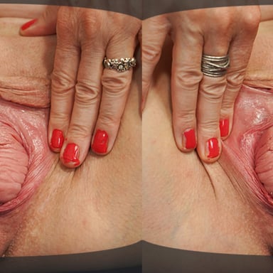Stepmom Prolapse Her Cervix full video